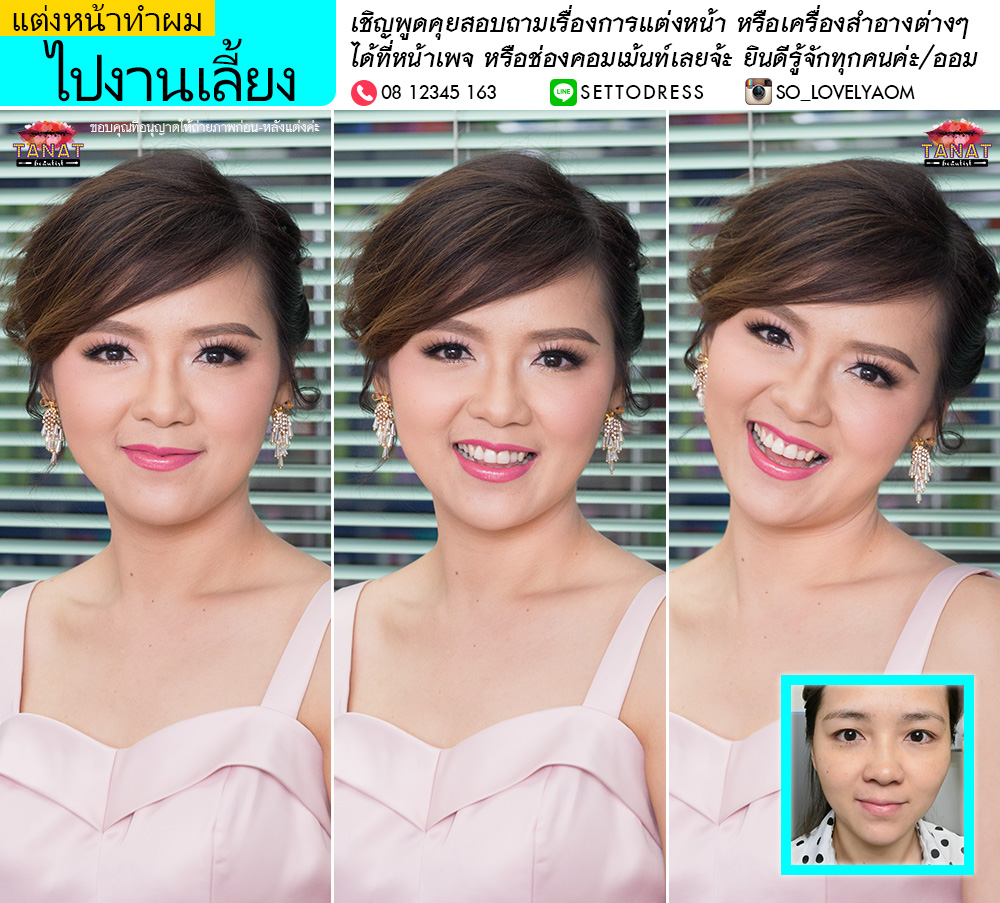 My Image 2